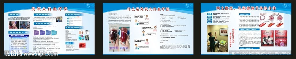 臭氧大自血疗法