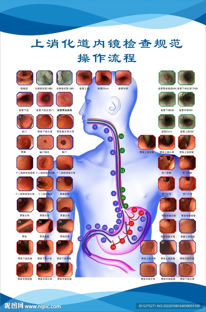 上消化道内镜检查规范操作流程
