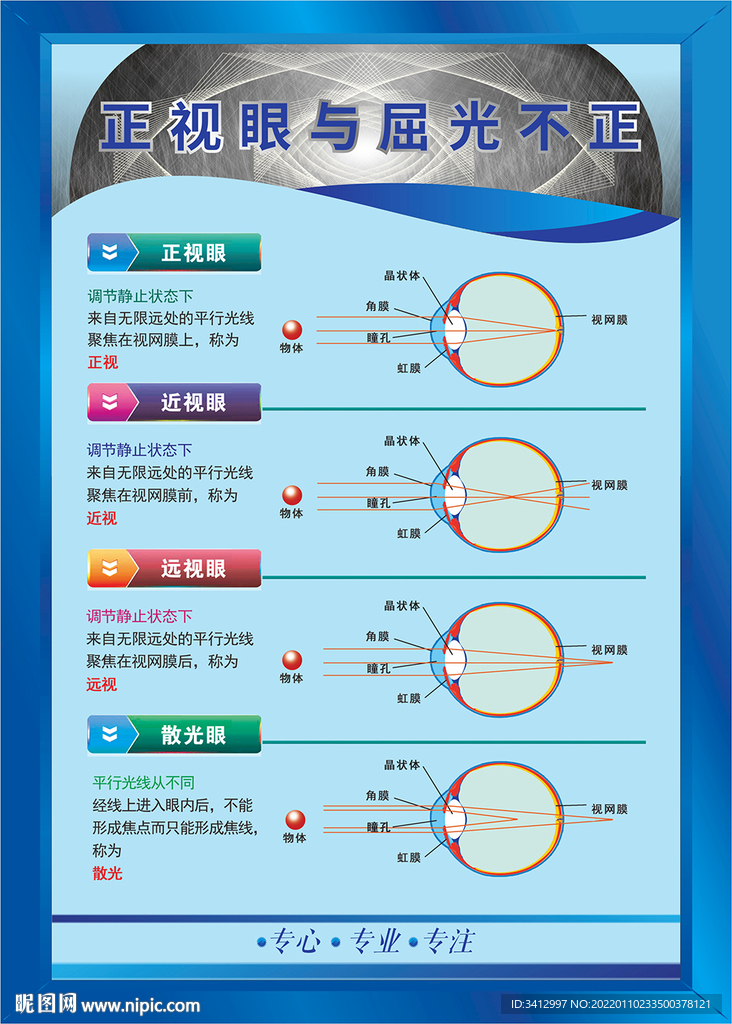 正视眼与屈光不正