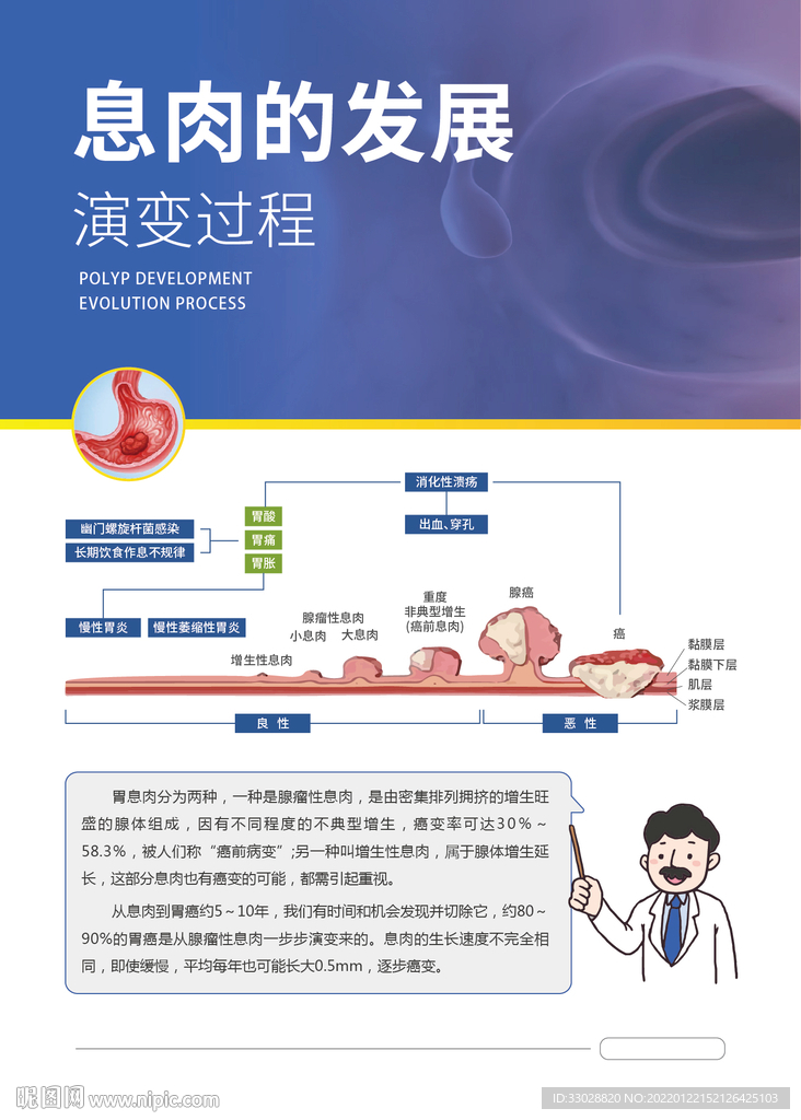 胃息肉的发展演变过程海报