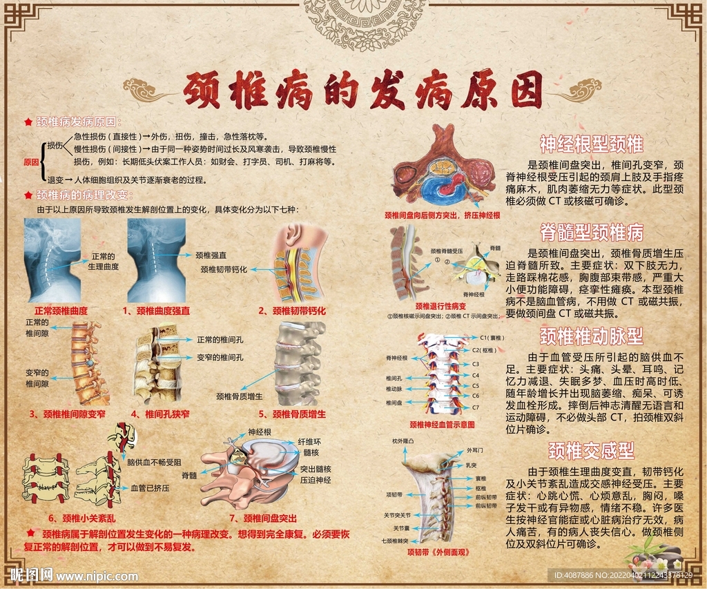 养生保健颈椎病发病原因
