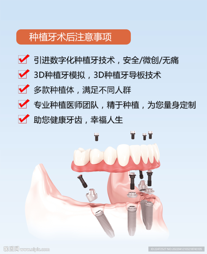 种植牙介绍
