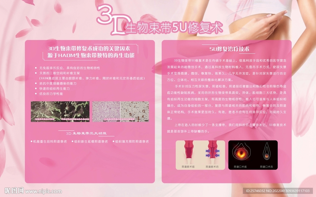3D生物束带 私密修复术