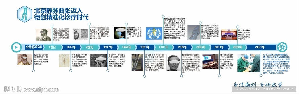 静脉曲张发展史