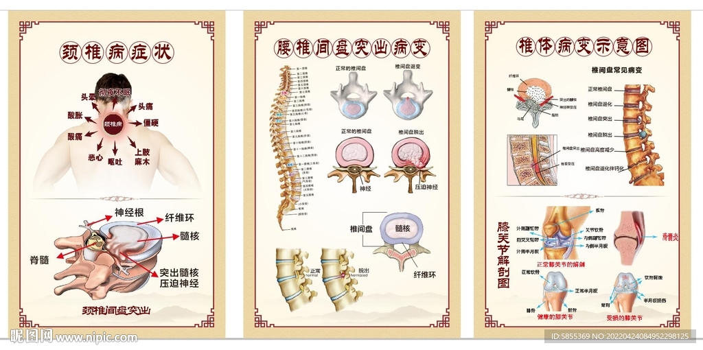 疼痛科挂图