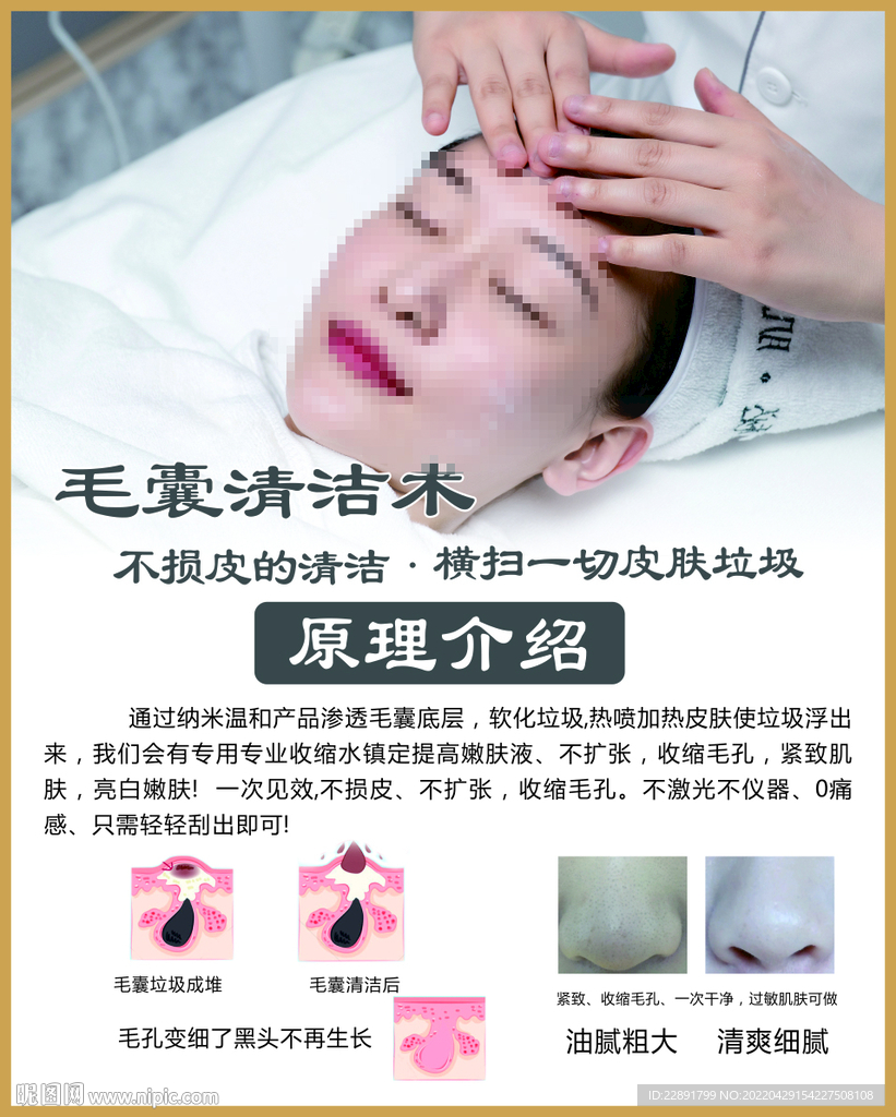 毛囊清洁