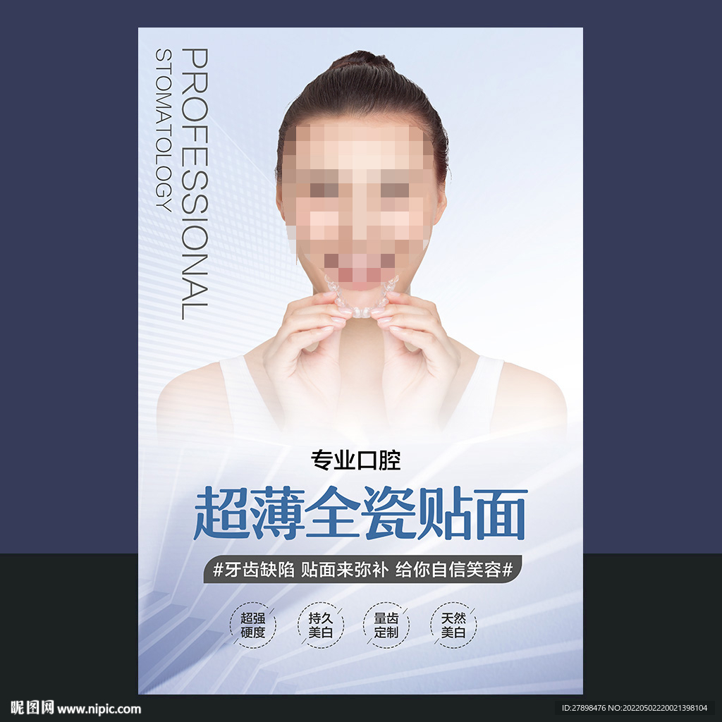 超薄瓷贴面