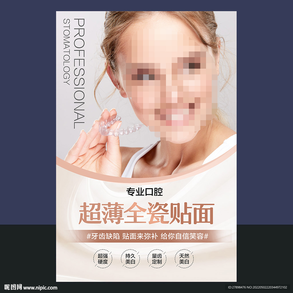 超薄瓷贴面