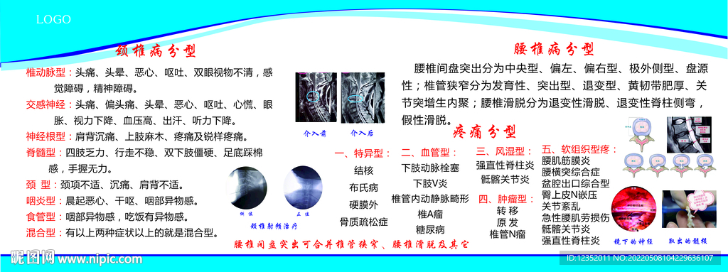 颈腰椎病分型展板