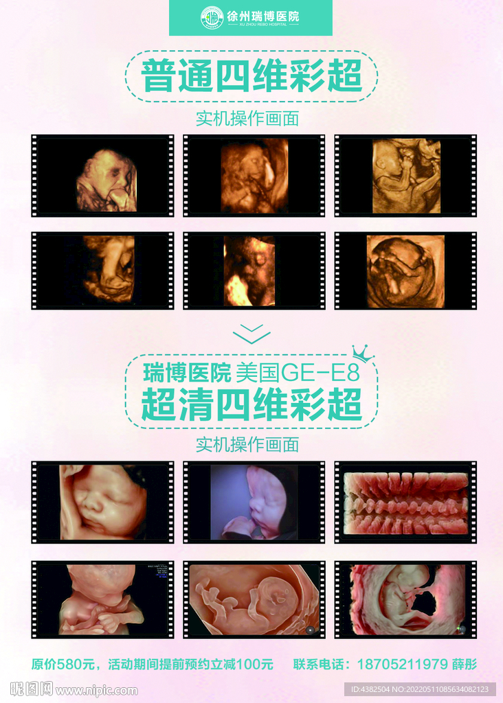 四维彩超对比图