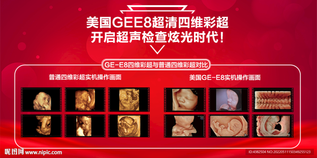 高清四维彩超对比图