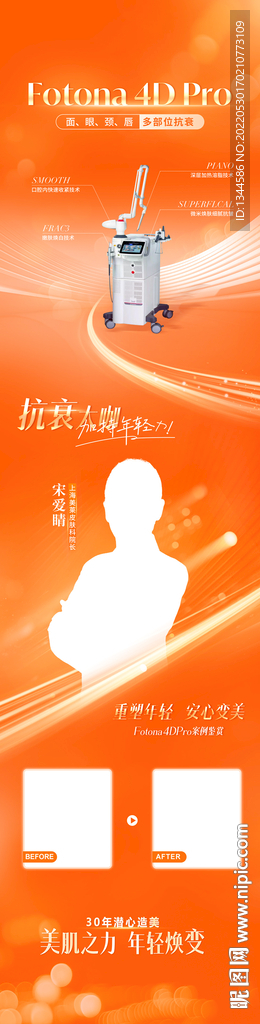 落地页推广