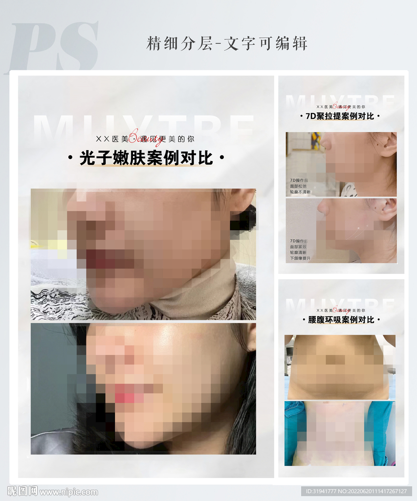 医美案例模板