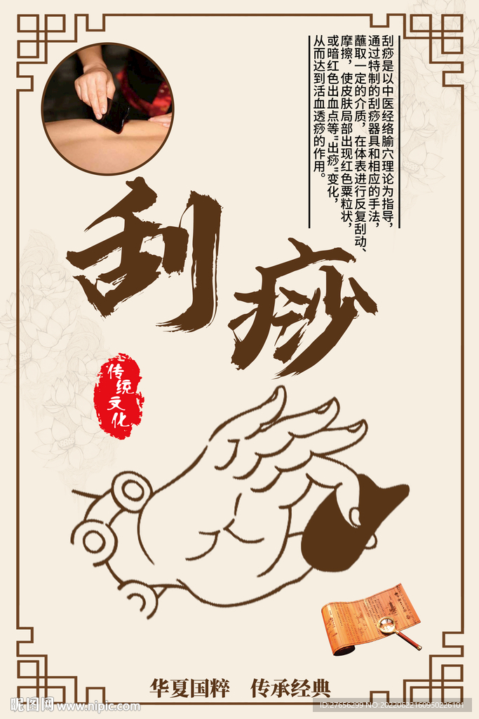刮痧