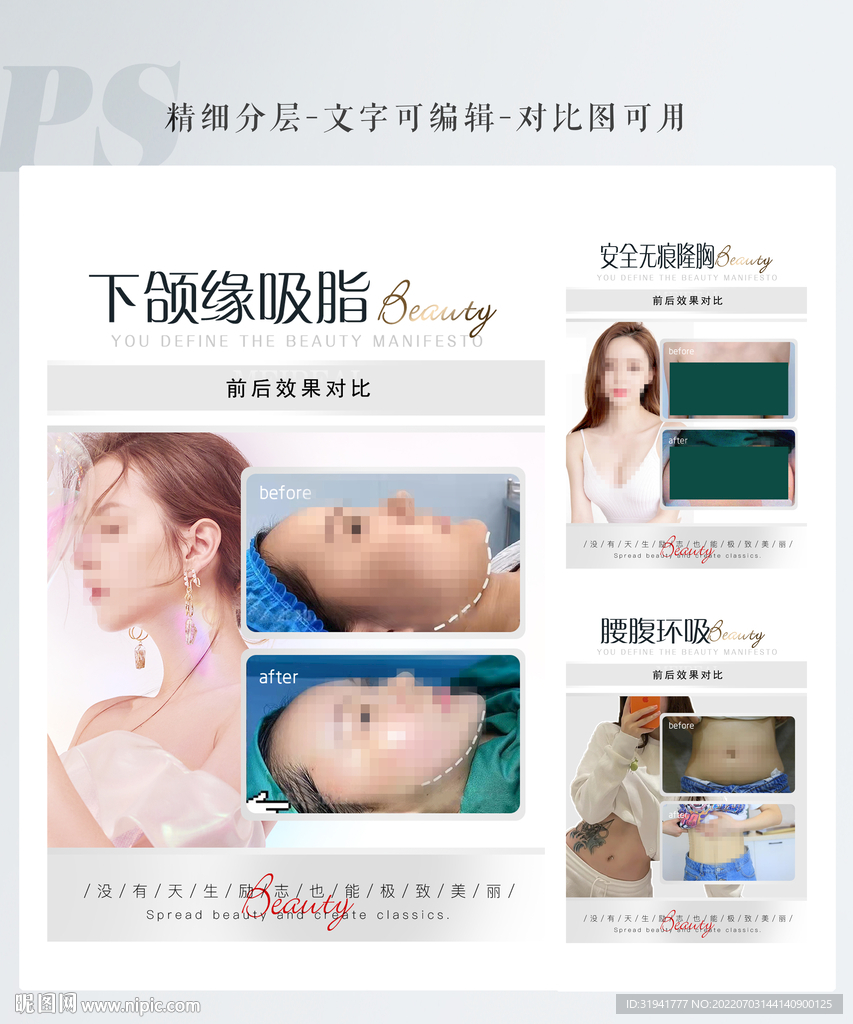 医美案例模板
