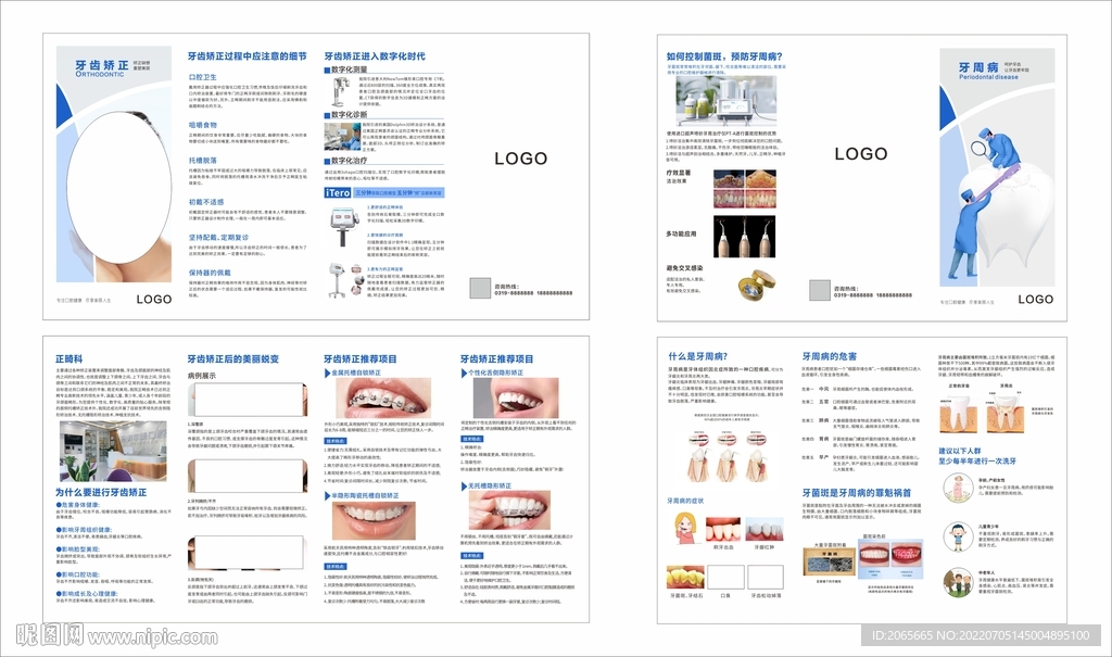 牙周病牙齿矫正