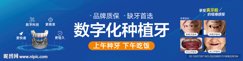 数字化种植牙