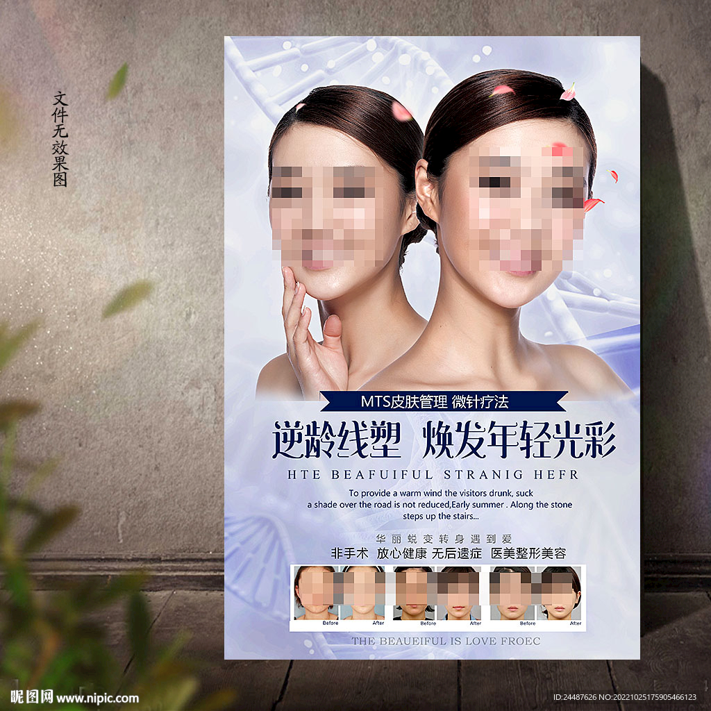 线雕