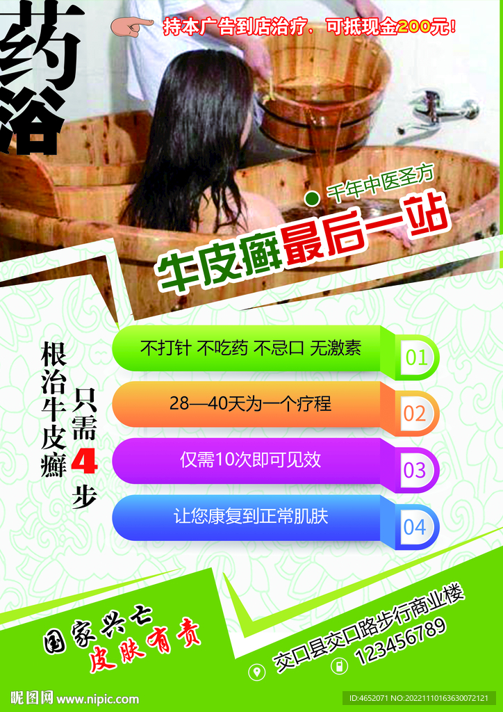 牛皮癣