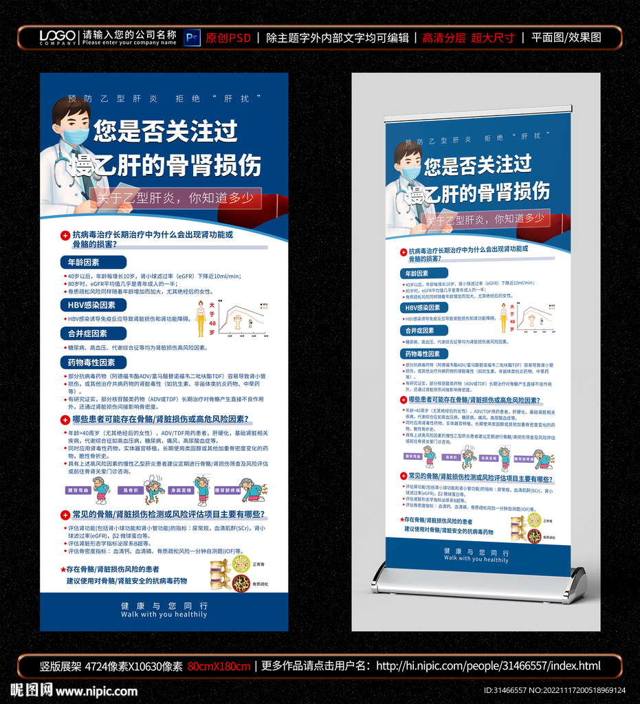 乙型肝炎展架