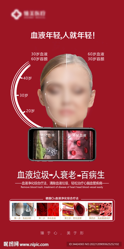 血液净化