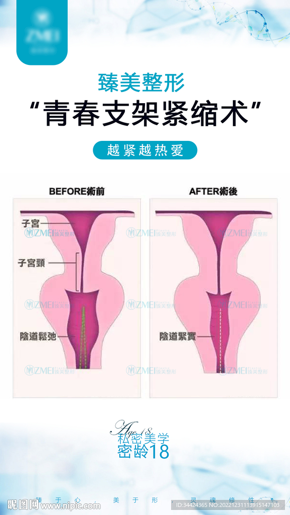 私密