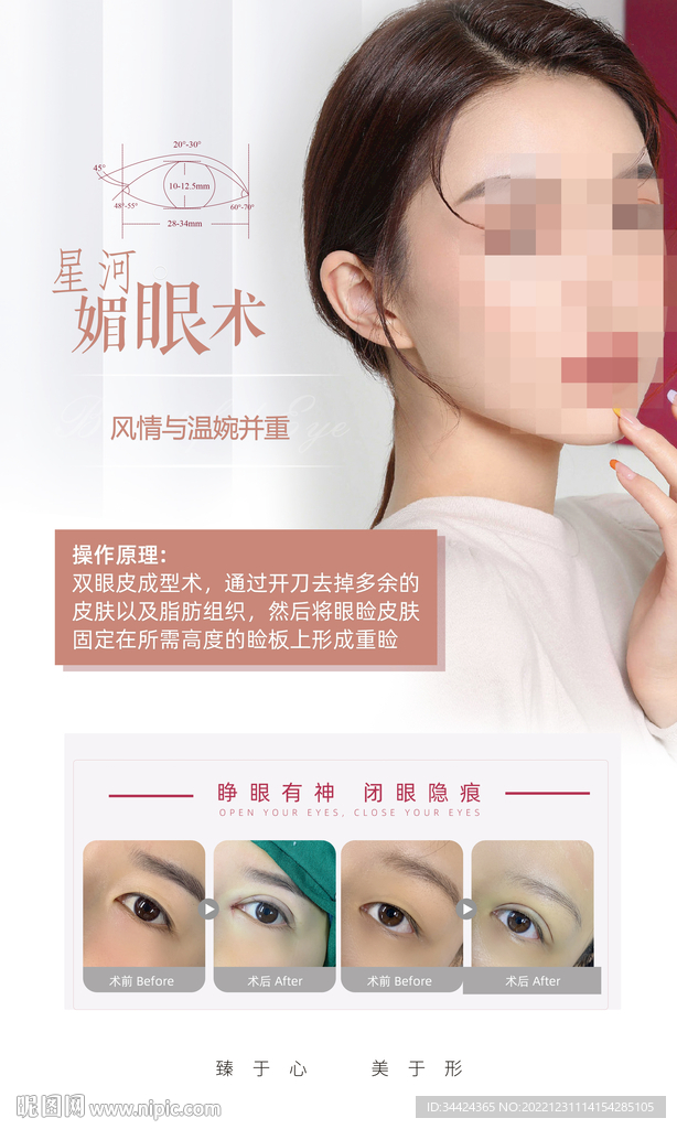 眼综合