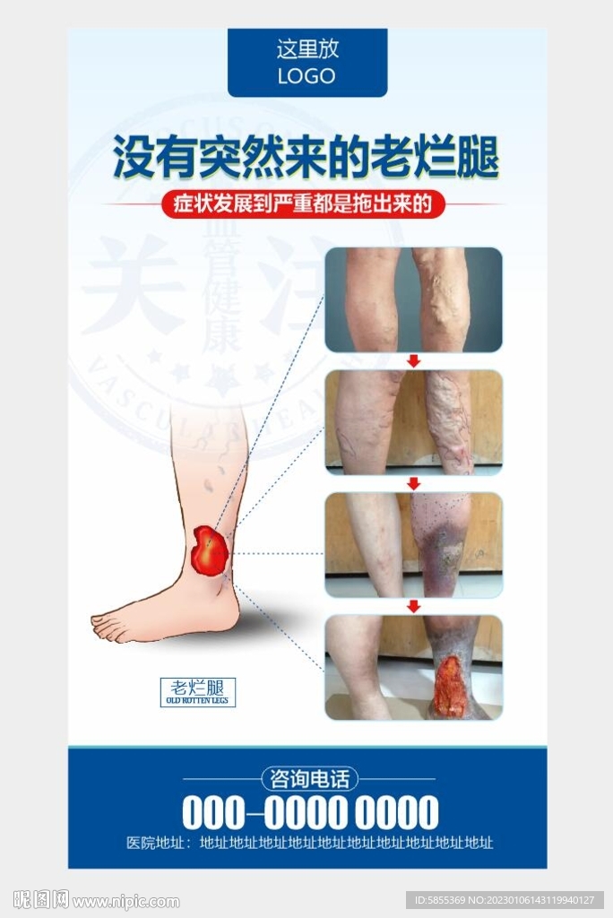 老烂腿海报