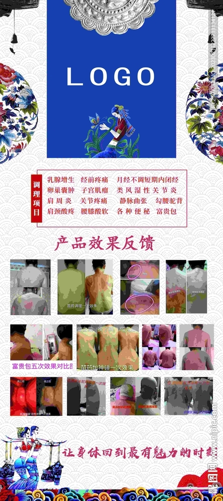 苗源世家对比图展架