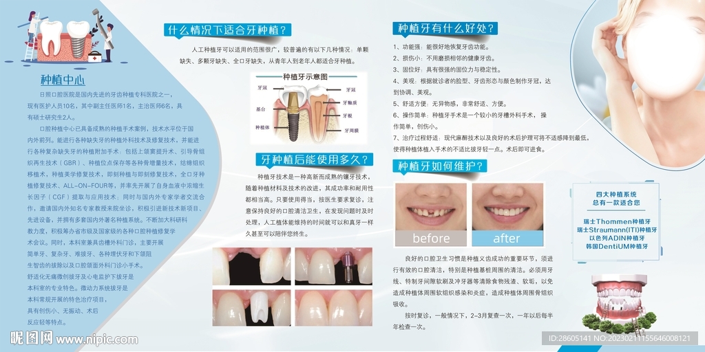 种植牙口腔牙科