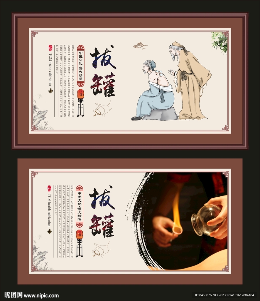 中医拔罐