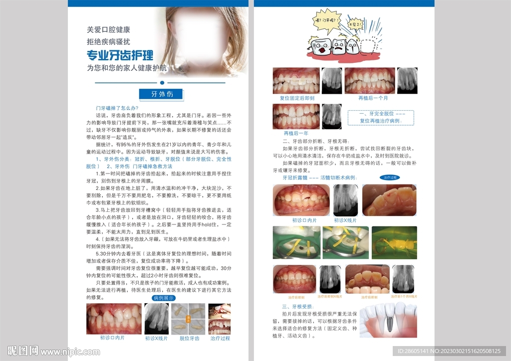 牙外伤牙根受损牙冠修复
