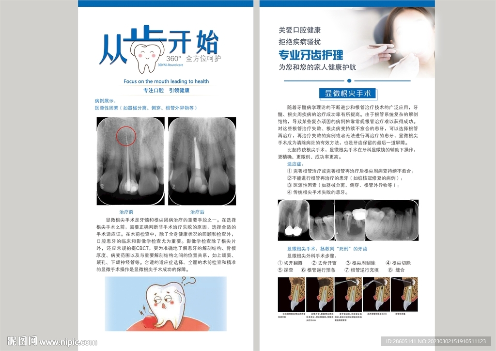 显微根尖手术牙科口腔