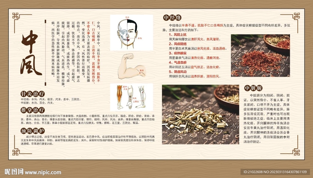 中风宣传展板