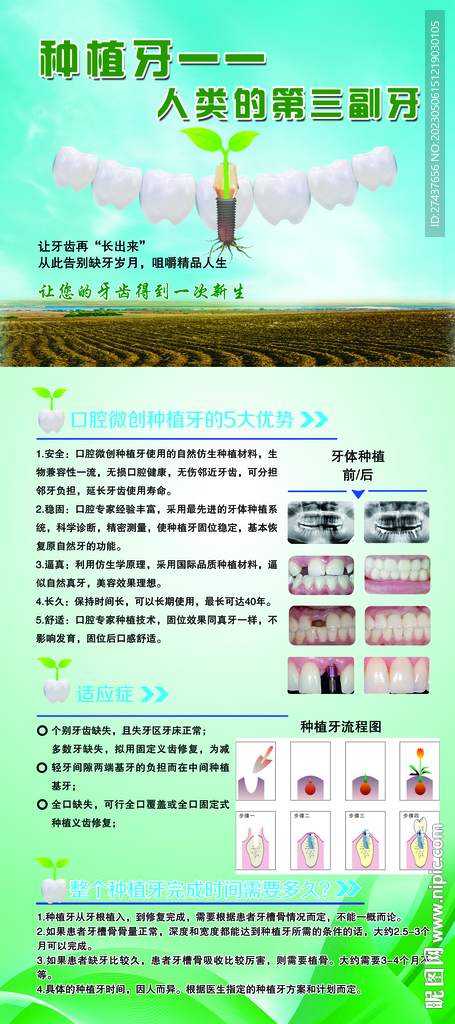 种植牙易拉宝