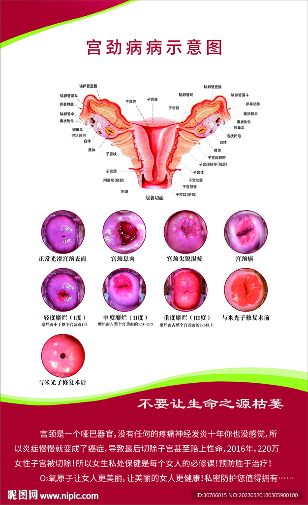 关爱女性健康