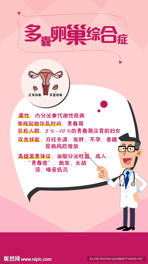 什么是多囊卵巢综合征