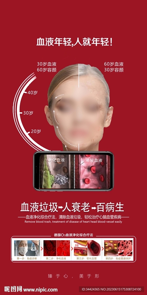 血液净化