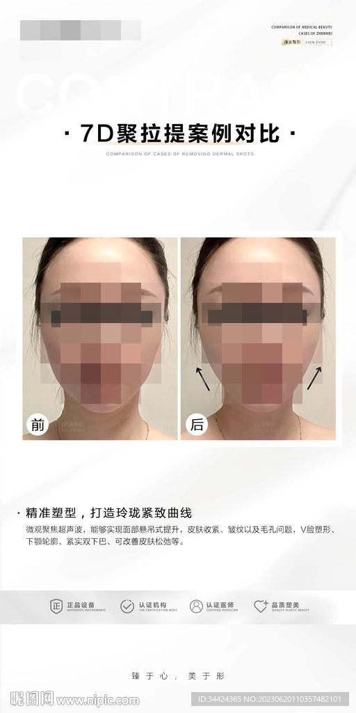7D聚拉提