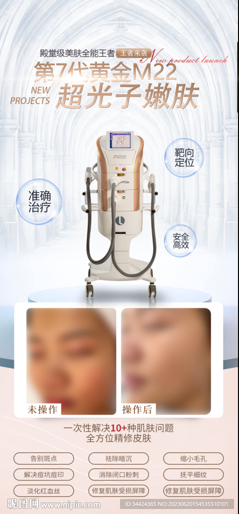 超光子嫩肤