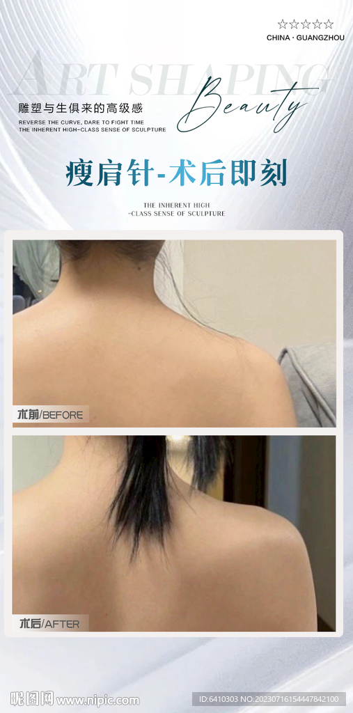 瘦肩针案例对比