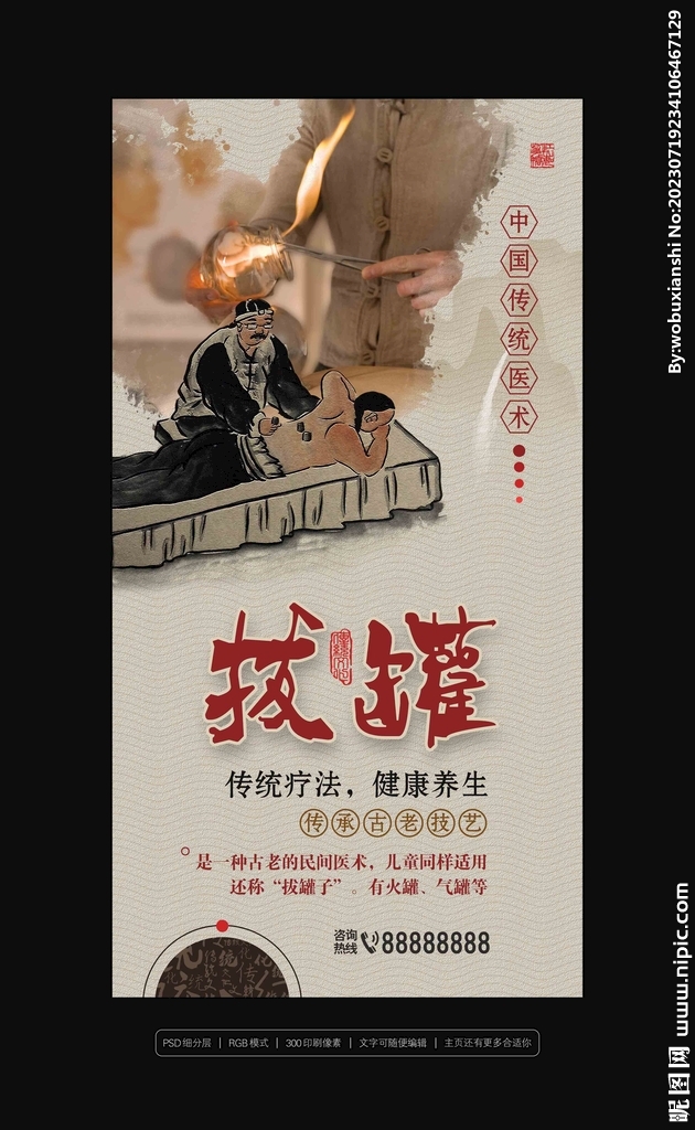 拔罐