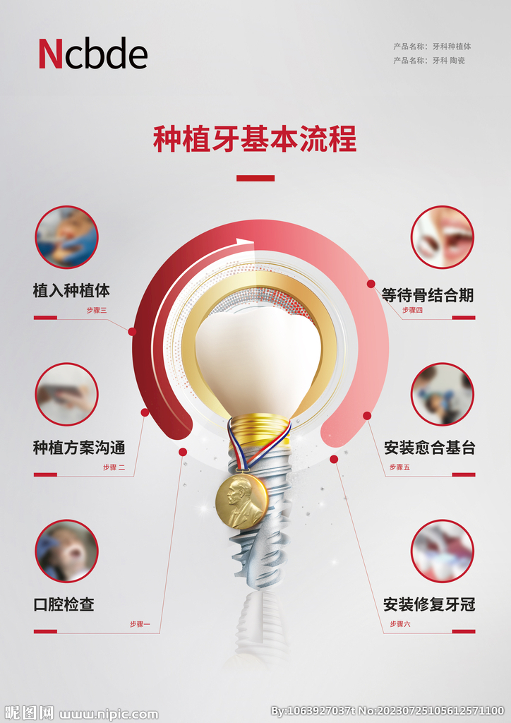 牙科种植牙流程图
