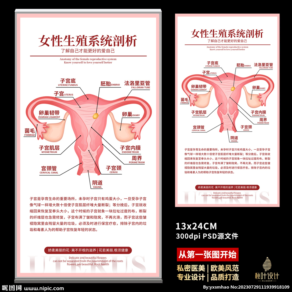 女性健康。子宫内膜异位症的解剖方案。子宫内膜疾病-生殖系统图插画图片素材_ID:374604342-Veer图库