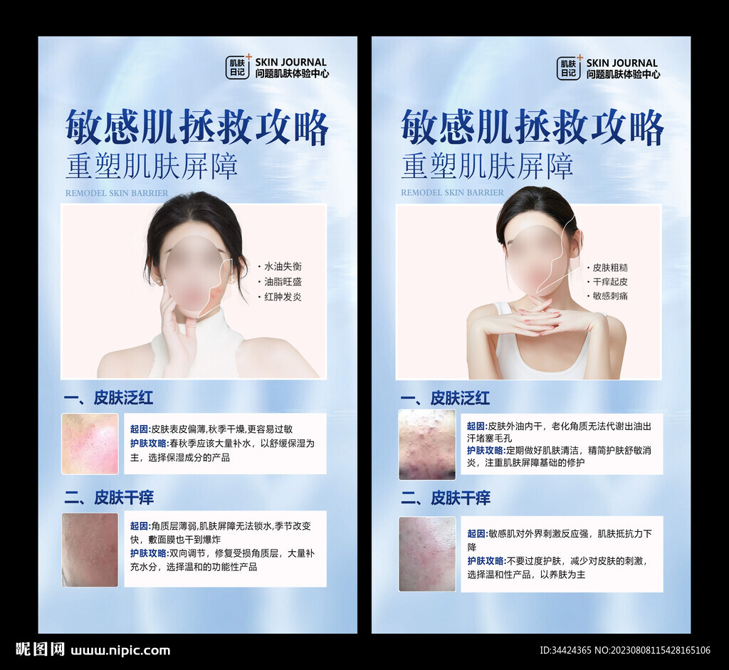 敏感肌