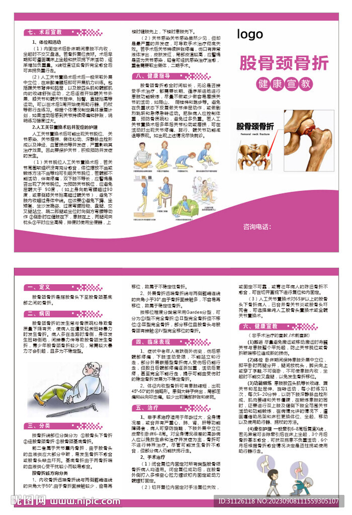 股骨颈骨折三折页