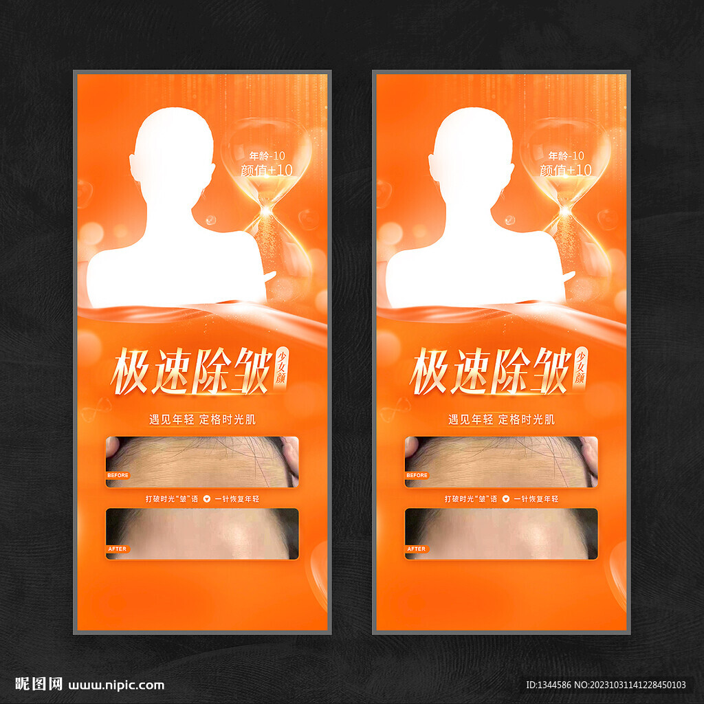 抬头纹