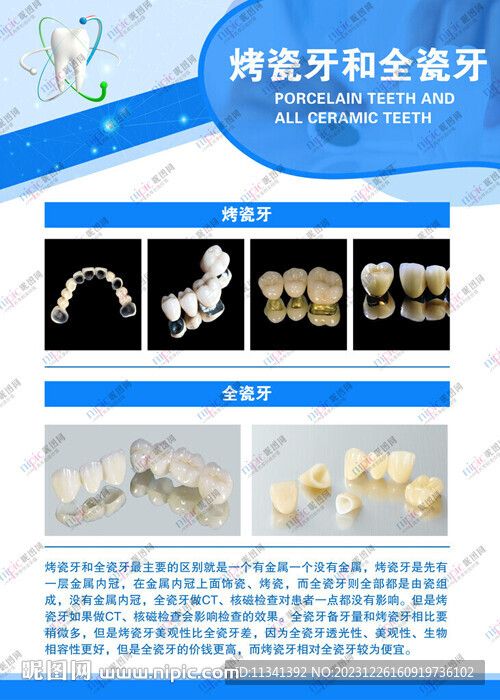 烤瓷牙全瓷牙