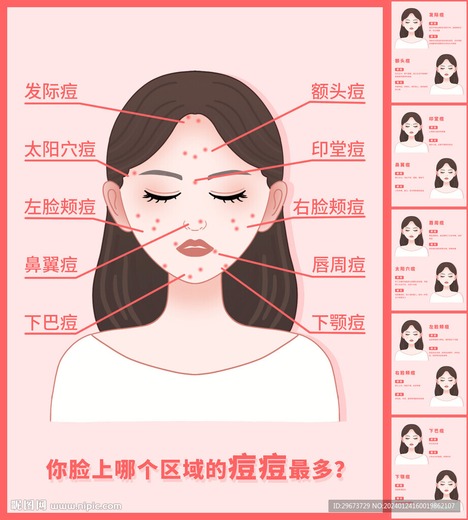 痘痘分布图分层