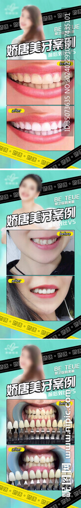 医美案例对比